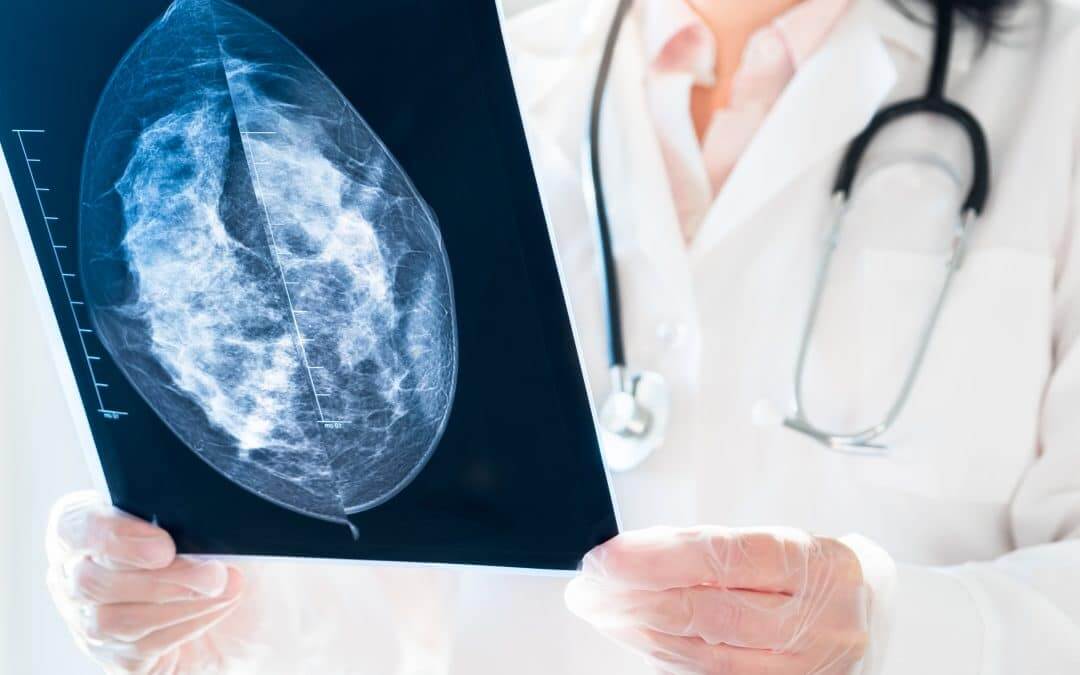 COVID-19 significantly impacts on the number of breast cancer screenings during Breast Cancer Awareness Month